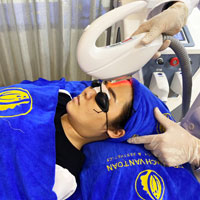 Bs thực hiện IPL