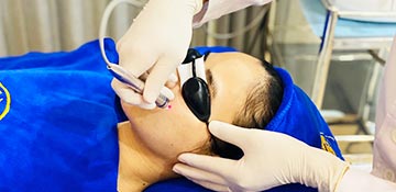 Dịch vụ điều trị mụn