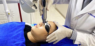 Dịch vụ điều trị nám