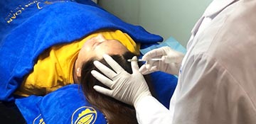 Điều trị rụng tóc