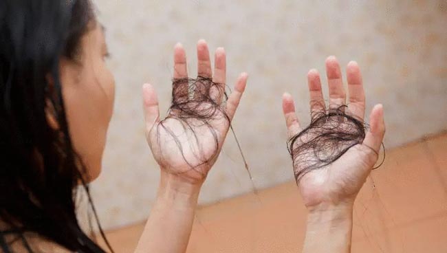 Tóc rụng nhiều sau C.0.V.I.D